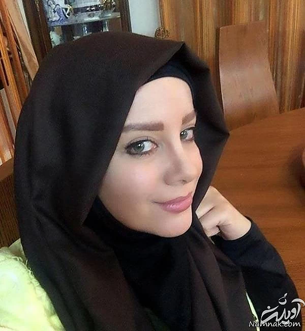 چهره شراره رخام پس از تخلیه ژل لب هایش + تصاویر شراره رخام